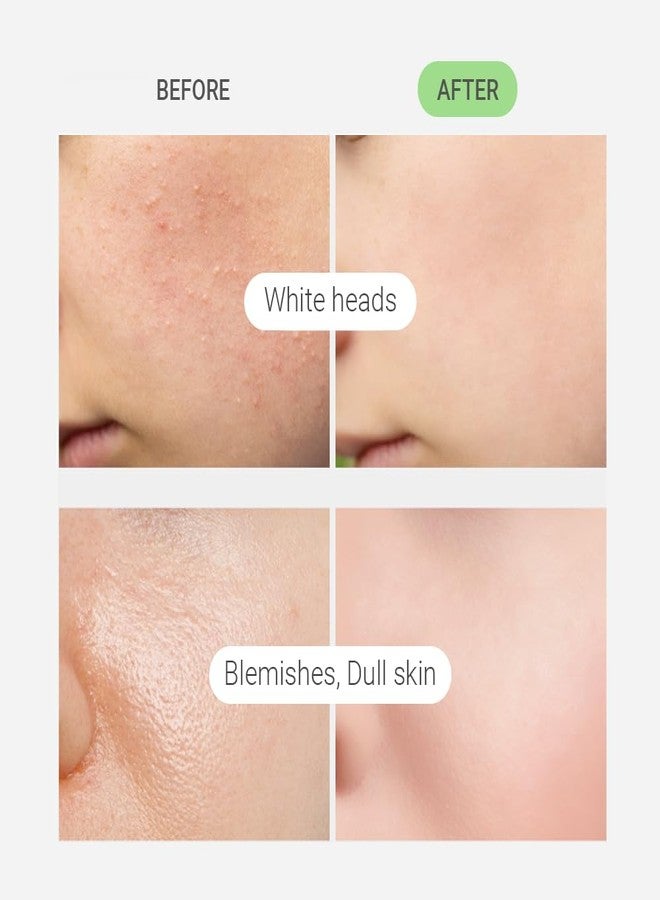 TENZERO CICA Bubble Toner, 4.73 fl oz/140ml, Hydrating & Soothing Centella Toner for Face, Barrier Repair, Korean Bubble Skincare - Image 3