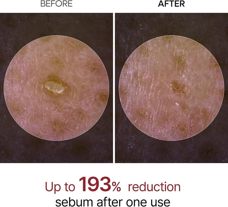 Dr. Melaxin Dr.Melaxin Peel Shot Glow Black Rice Peeling Ampoule - Image 3