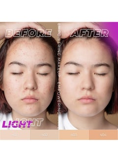 LAMEL LAMEL OhMy Clear Face Full Coverage Foundation - Acne Coverage - Salicylic Acid & Tea Tree Extract - Dewy & Flawless Finish - Sensitive Skin Care - Organic & Oil-Free - 401, 1.35 fl.oz  - Image 3