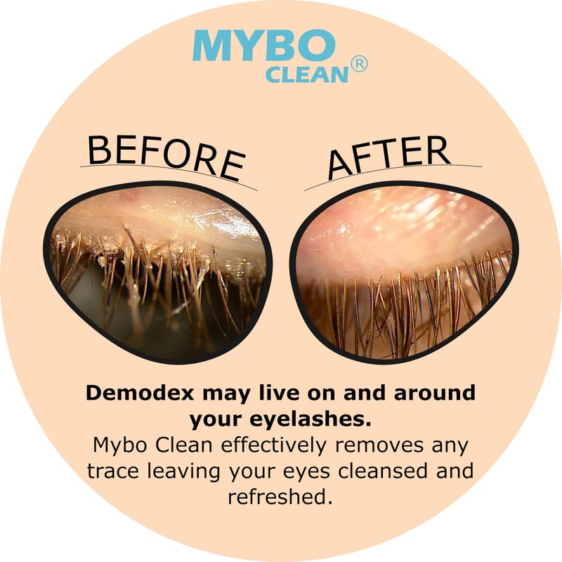 Myboclean جل تنظيف الجفون والرموش المرطب من مايبوكلين، عسل مانوكا UMF 16+، صبار، زيت جوز الهند، ملح البحر الأحمر، 1.69 أونصة سائلة - Image 3