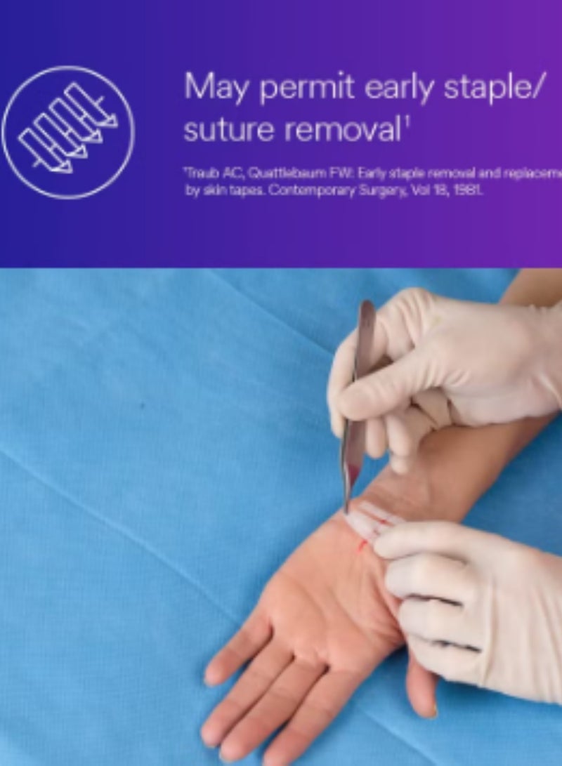 ستيري ستريب شرائط 3M™ ستيري-ستريب™ اللاصقة المعززة لإغلاق الجلد، R1547، 1/2 بوصة × 4 بوصة (12 مم × 100 مم) - Image 3