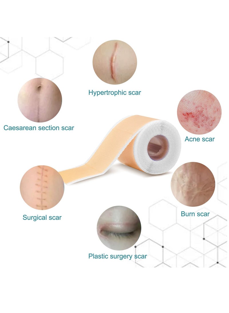 Elaimei لاصق ندبات سيليكون ذاتي اللصق لإزالة الندبات، شرائح سيليكون طبية، شريط سيليكون، لاصق جل سيليكون لإزالة ندبات جراحة شد البطن 4CM*1.5M - Image 3