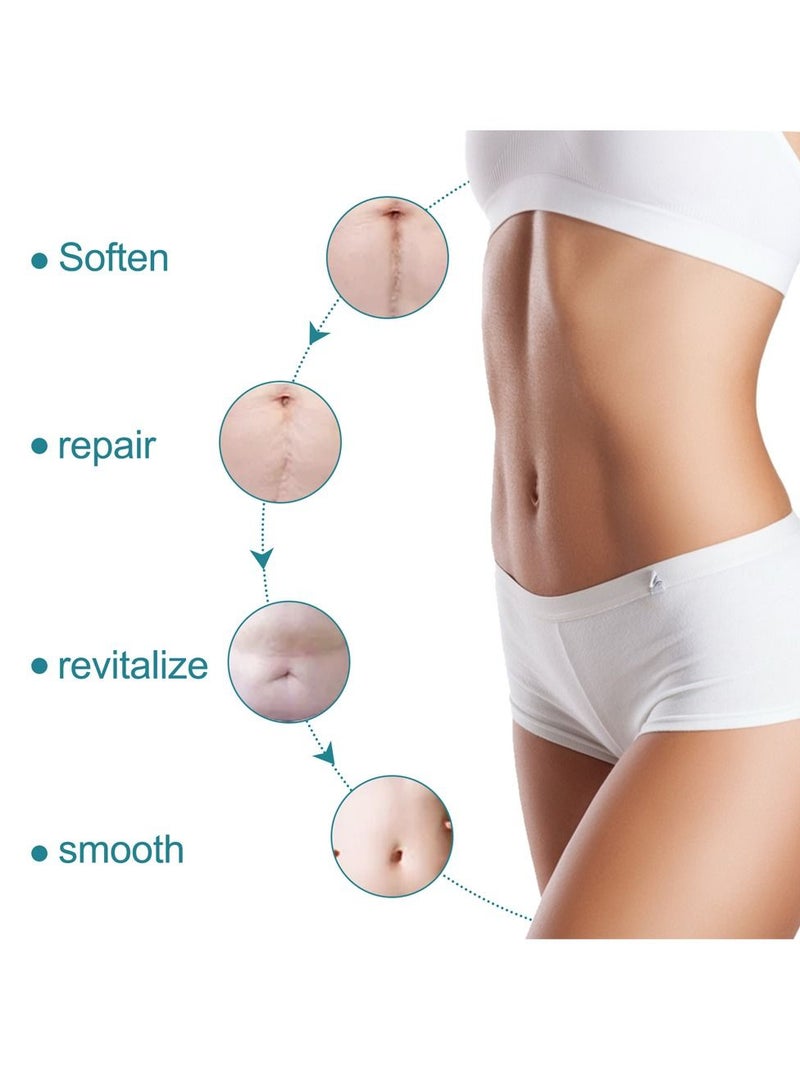 Elaimei لاصق ندبات سيليكون ذاتي اللصق لإزالة الندبات، شرائح سيليكون طبية، شريط سيليكون، لاصق جل سيليكون لإزالة ندبات جراحة شد البطن 4CM*1.5M - Image 5