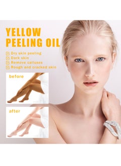 OUHOE 100ml Super Strength Yellow Peeling Oil Exfoliating Dark Skin for Body, Yellow Peeling Oil Body Whitening Skins, Butter Peeling Lightening Brighten Complexion for Cleansing and Moisturizing  - Image 2