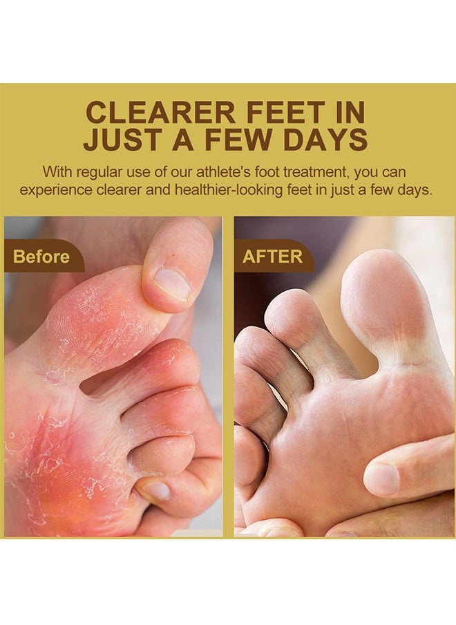 Sumifun - Athlete Foot Relieve Itching, Antibacterial Cream, Safe Mild Anti-Itch Ointment, for Burning, Athlete's Foot, Foot Sweat, Itching 20g - Image 1