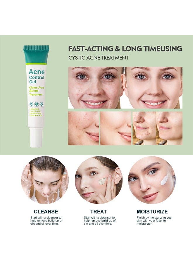 MOOYAM Acne Control Gel，Clears Acne, Acne Treatment Cream,Acne Spot Treatment gel,Clear Acne Spot Treatment Gel,Pimple Cream for Acne Prone Skin Care,Acne Control Gel,Salicylic Acid Acne Treatment Gel,Clear Breakouts, 30g  - Image 3