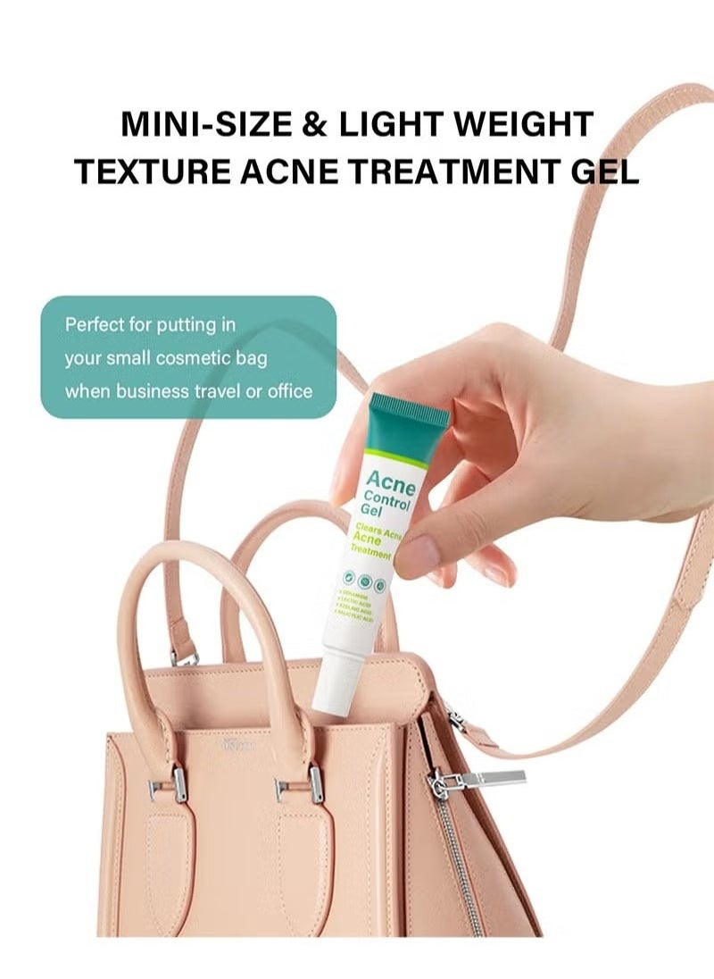 MOOYAM - Acne Treatment Cream,Acne Spot Treatment gel,Clear Acne Spot Treatment Gel,Pimple Cream for Acne Prone Skin Care,Acne Control Gel,Salicylic Acid Acne Treatment Gel,Clear Breakouts, 30g - Image 1