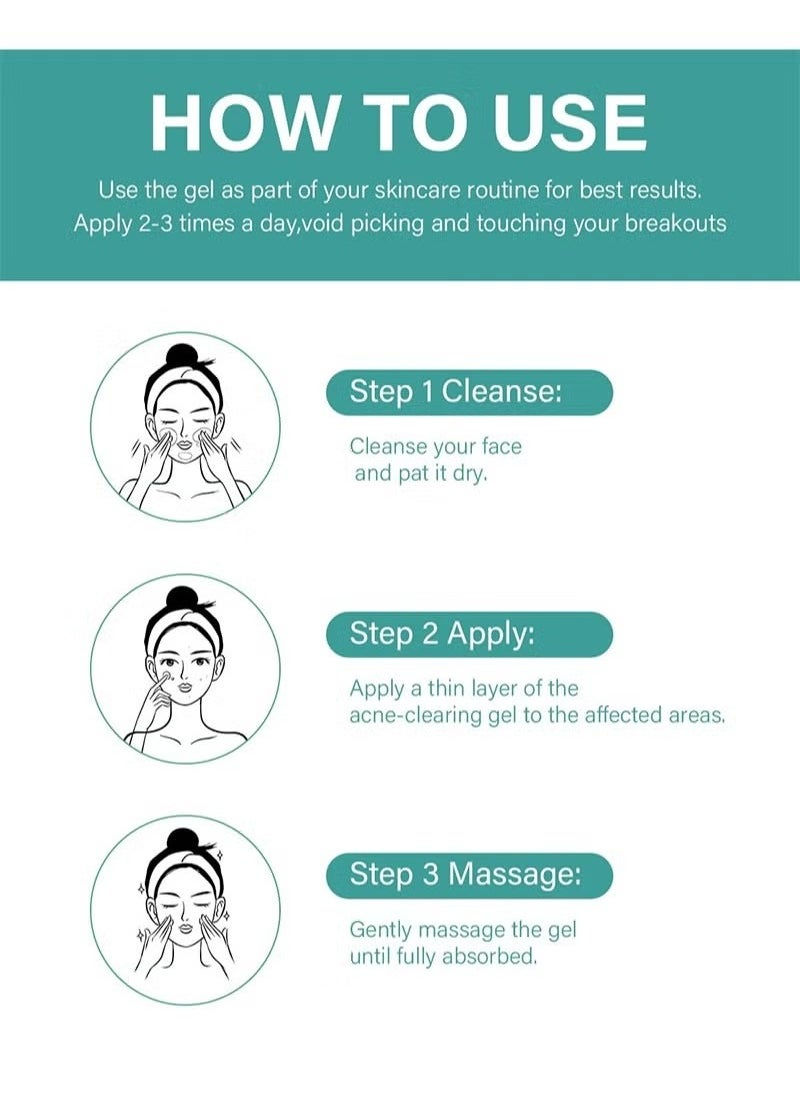 MOOYAM - Acne Treatment Cream,Acne Spot Treatment gel,Clear Acne Spot Treatment Gel,Pimple Cream for Acne Prone Skin Care,Acne Control Gel,Salicylic Acid Acne Treatment Gel,Clear Breakouts, 30g - Image 1