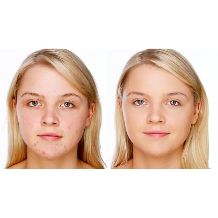 مجموعة ديرم آكتيف أكتي-كلير – غسول لطيف 200 مل + كريم مطفٍ ومرطب 50 مل – عناية متكاملة للبشرة الدهنية والمختلطة – ينقي المسام ويقلل اللمعان – جودة فرنسية أصلية - Image 2