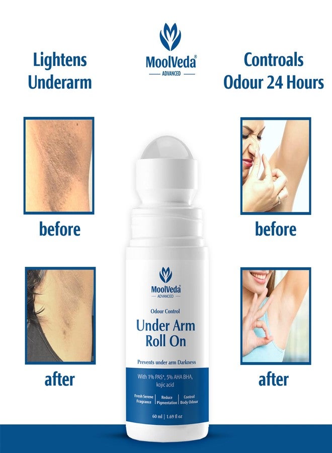 Moolveda 5% AHA BHA Underarm Roll On 60ml - Odour Control & Pigmentation Removal for Men Women | Lactic Mandelic Salicylic Acid | Orchid Breeze - Image 4