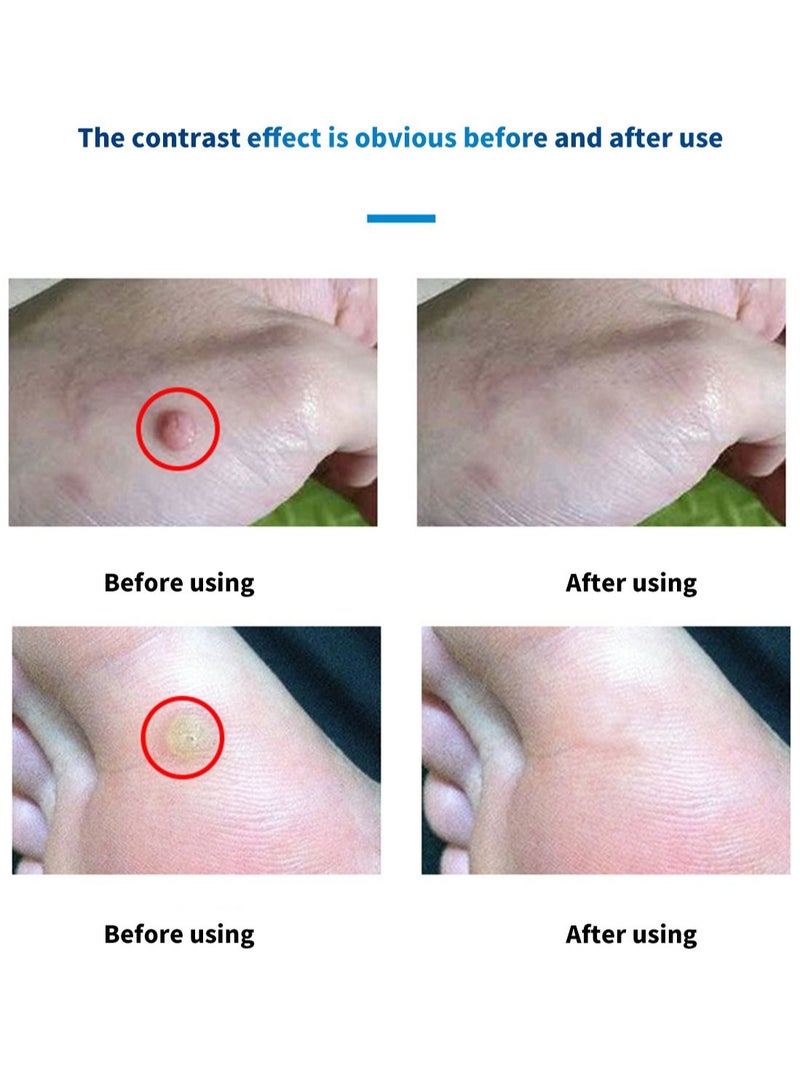 HEALMUSZ مزيل الثآليل تركيبة عشبية طبيعية آمنة وفعالة امتصاص عالي تأثير سريع توقف نمو الثآليل مرة أخرى مزيل ثآليل غير مهيج لجميع أنواع البشرة 10 مل - Image 4