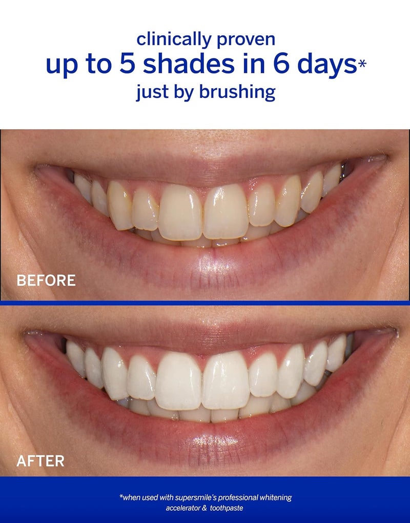Supersmile Professional Whitening Accelerator  Powerful Whitening without Sensitivity  Safe and Effective on Dental Restorations 36 Oz - Image 2