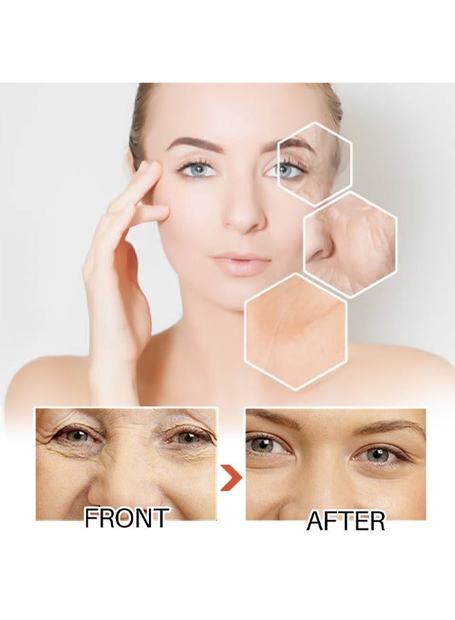 Lanthome Glutathione White Cream, Kojic Acid Brighting Dark Spots Acne Scars Intensively Hydrating Soothing Cream 50g - Image 3