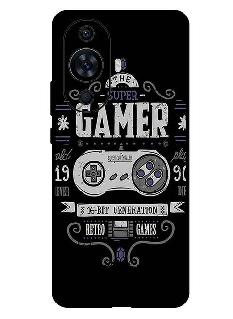 Protective Case Anti Scratch Shock Proof Bumper Cover For Huawei Nova 11 Ultra Super Gma