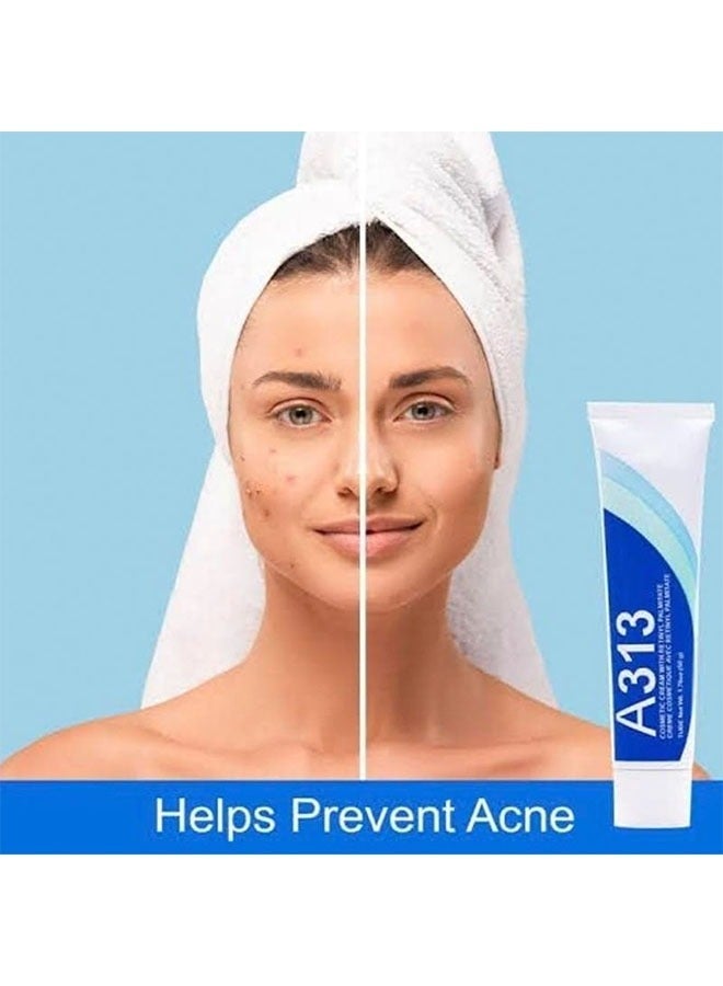 A313 Retinol Cream for Face, Anti-Ageing Treatment, Skin Brightening and Hydrating, 50g - Image 2