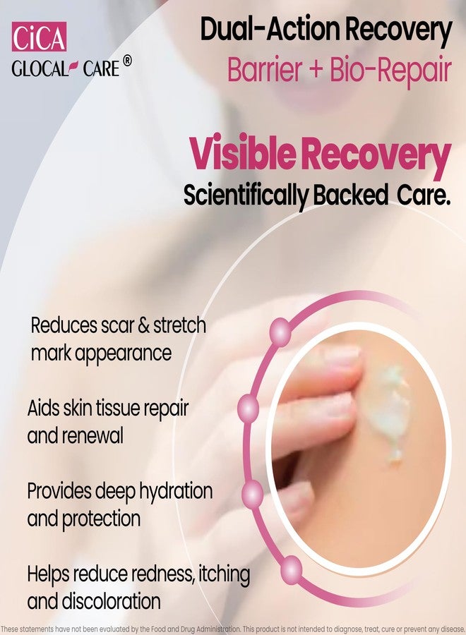 GlocalCare كريم سيكا سيليكون لعلاج الندبات - تحسين مظهر الندبات الجديدة والقديمة، وعلامات التمدد، والتصبغات الناتجة عن التهاب الجلد - سيليكون طبي مع تيكا، وباسيولين، وحمض الهيالورونيك، وبانثينول - يدعم التئام الجروح - 50 مل - Image 2