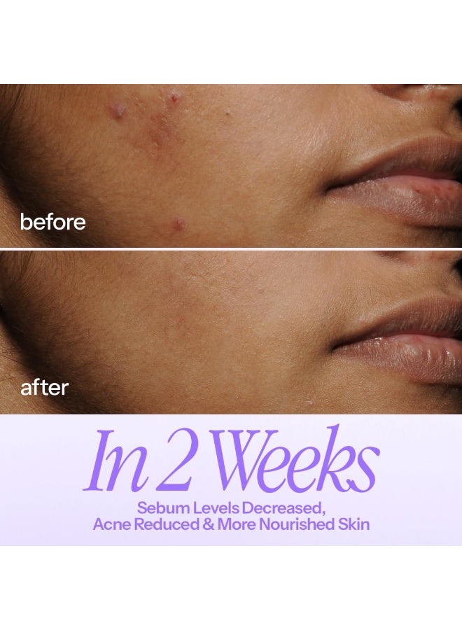 ديو تونر حليبي مهدئ من دي يو إنبالانس | مرطب | يستهدف الالتهابات | يهدئ التهيج | حماية مضادة للأكسدة | للرجال والنساء | 100 مل - Image 4