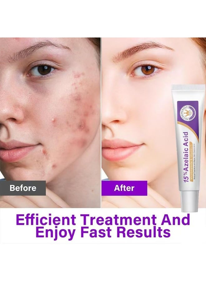 15% Azelaic Acid Acne Cream, Azelaic Acid Serum, Vitamin C u0026 Hyaluronic Acid u0026 Niacinamide Facial Treatment,Redness Relief Face,Smoothing Skin and Blemish, Clears Pores (1pc) - Image 2