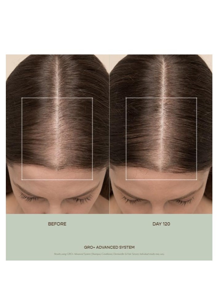 VEGAMOUR - VEGAMOUR GRO+ Advanced Hair Serum | Improves Hair Density, Reduces Shedding and Promotes a Balanced Scalp | For Severe Signs of Thinning | Formulated Without Fragrance, Vegan, Cruelty-Free - Image 1