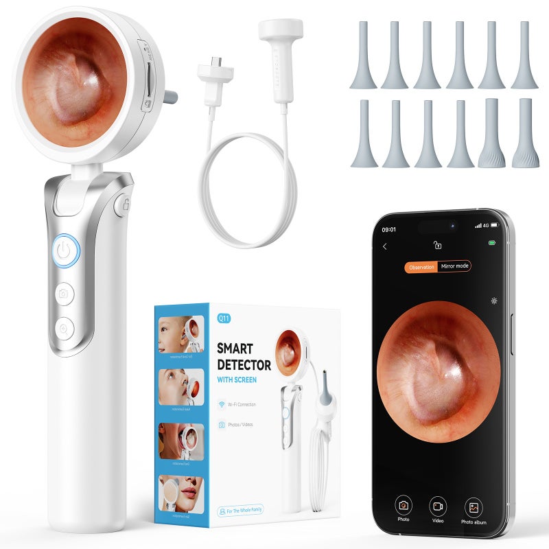 Cross-Border New Portable Handheld Endoscope with 1080P HD Screen for Ear and Nose Inspection - Image 2