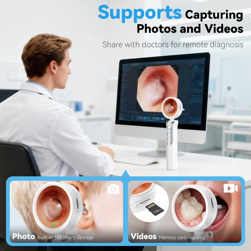 Cross-Border New Portable Handheld Endoscope with 1080P HD Screen for Ear and Nose Inspection - Image 5