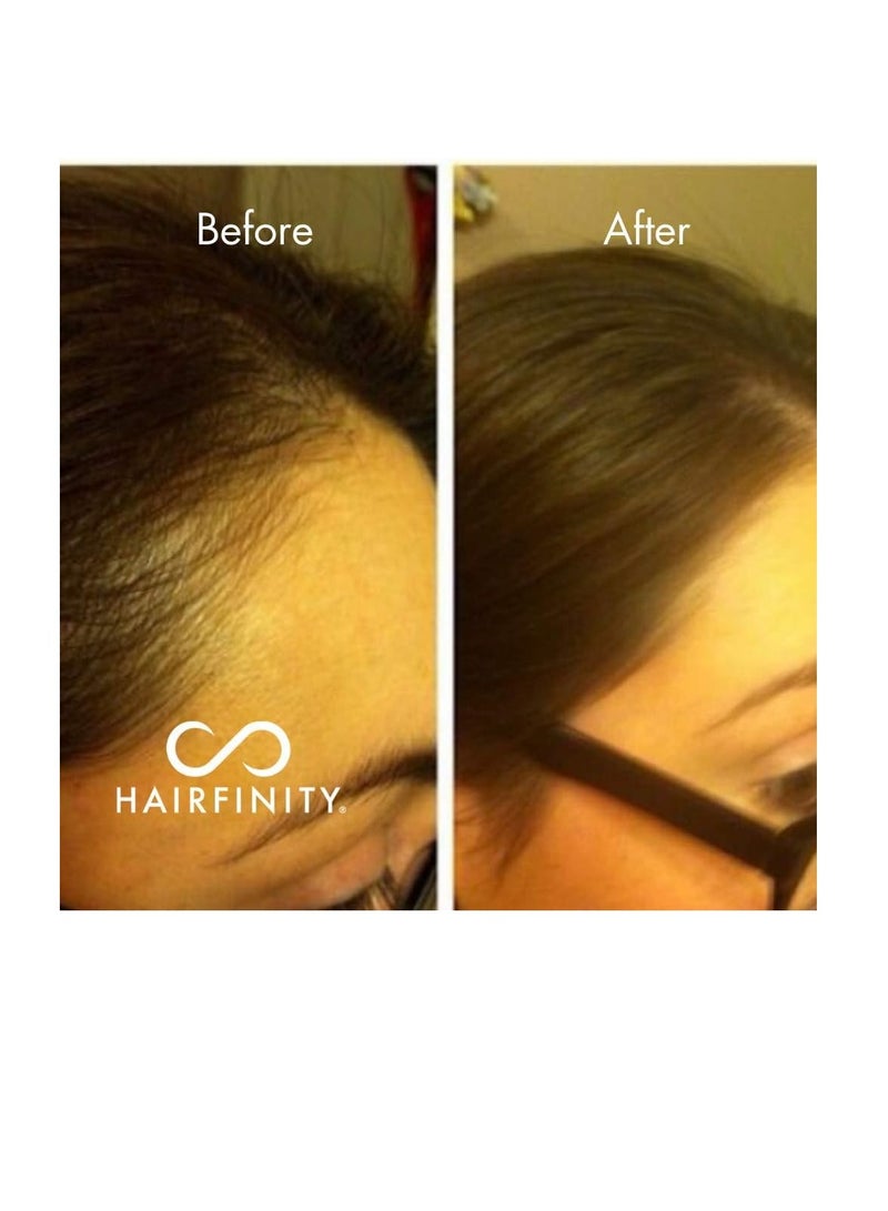 HAIRFINITY Infinite Edges Spot Serum for Hair Growth Treatment 15ml - Image 3