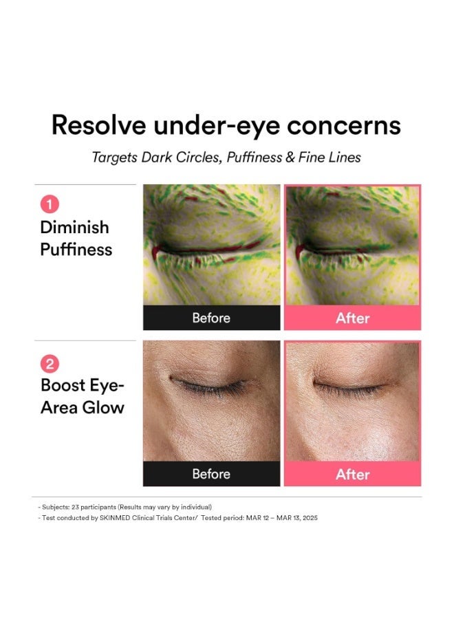 Abib PDRN Retinal Eye Patch, Hydrogel Masks for Dark Circles, Puffiness, Fine Lines, 60 Patches, 84g, with Niacinamide, K-Beauty Skincare - Image 4