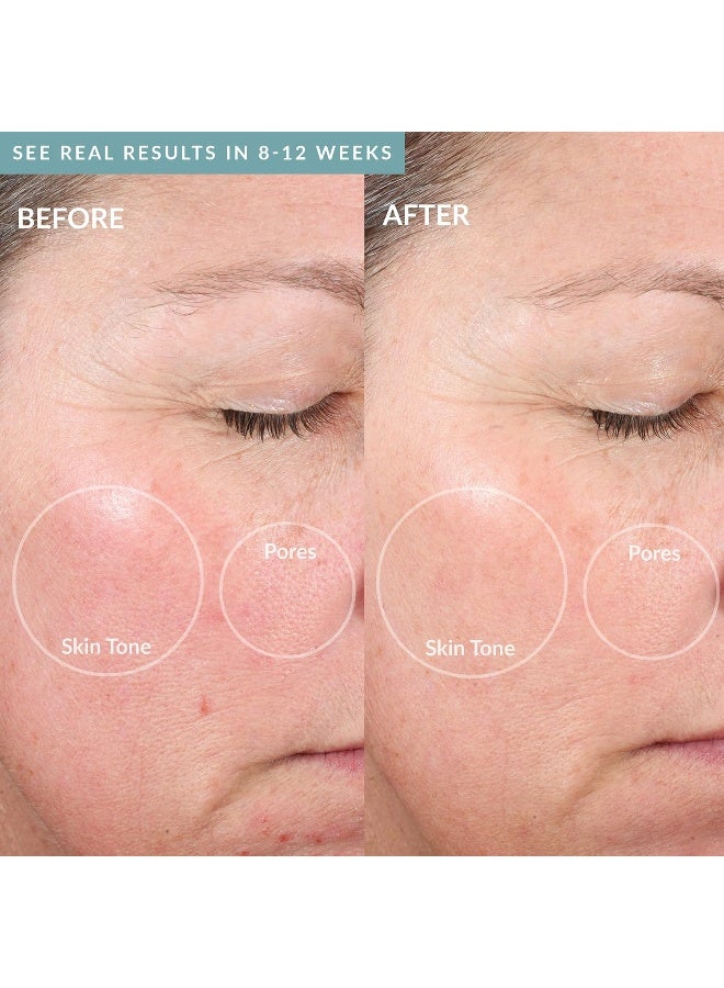 PMD Renewed - Personal Microderm Elite Pro Sky - At-Home Microdermabrasion Machine with Kit for Face and Body - Exfoliating Crystals and Vacuum Suction for Fresh and Radiant Skin - Three Speed and Suction Options - Image 5