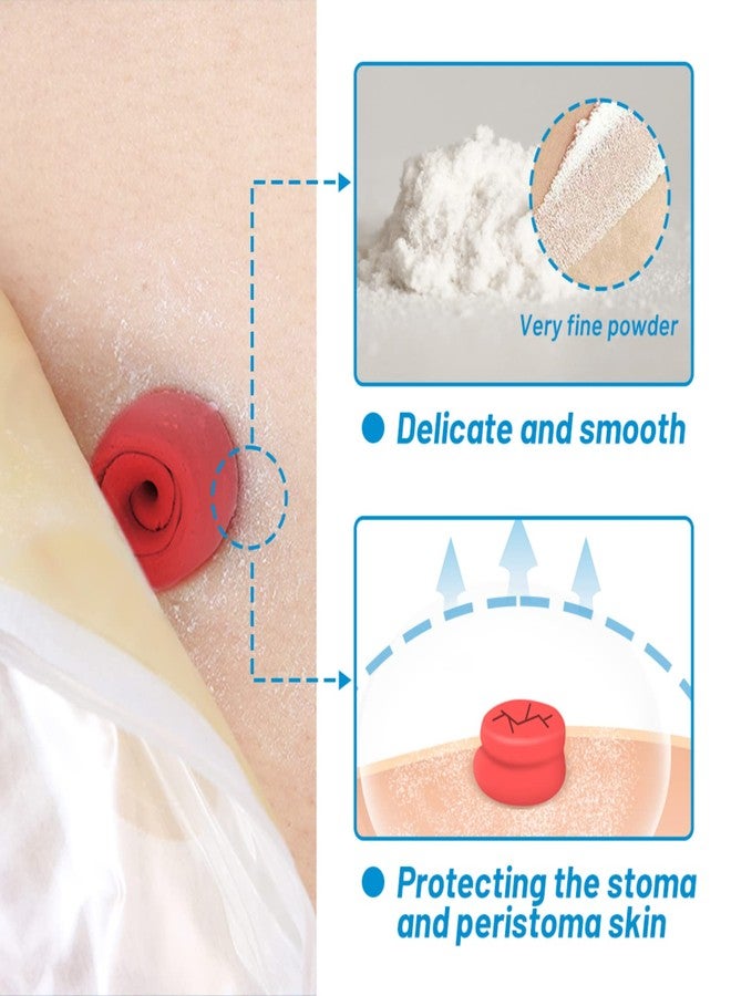 Heagimed Stoma Powder, Skin Barrier Protection Ostomy Powder Supplies, Stoma Adhesive Powder, Ostomy Skin Care Powder, Ostomy Supplies(25g - Image 2