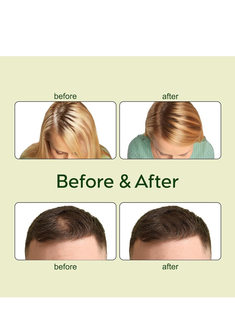 إيلهو زيت نمو الشعر النباتي الطبيعي ، زيت نمو الشعر النباتي بزيت إكليل الجبل ، زيت الخروع ، زيت الأرغان ، زيت البطاطا الحلوة الخام ، زيت نباتي (30 مل * 2) - Image 5