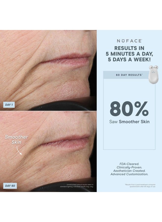 Sheer Miracle - FDA Cleared LED Red Light Wrinkle Reducer Attachment for Trinity Microcurrent Facial Device - At Home 3-Minute Fine Lines and Wrinkles Treatment for Smile Lines, Under Eyes & Forehead - Image 1