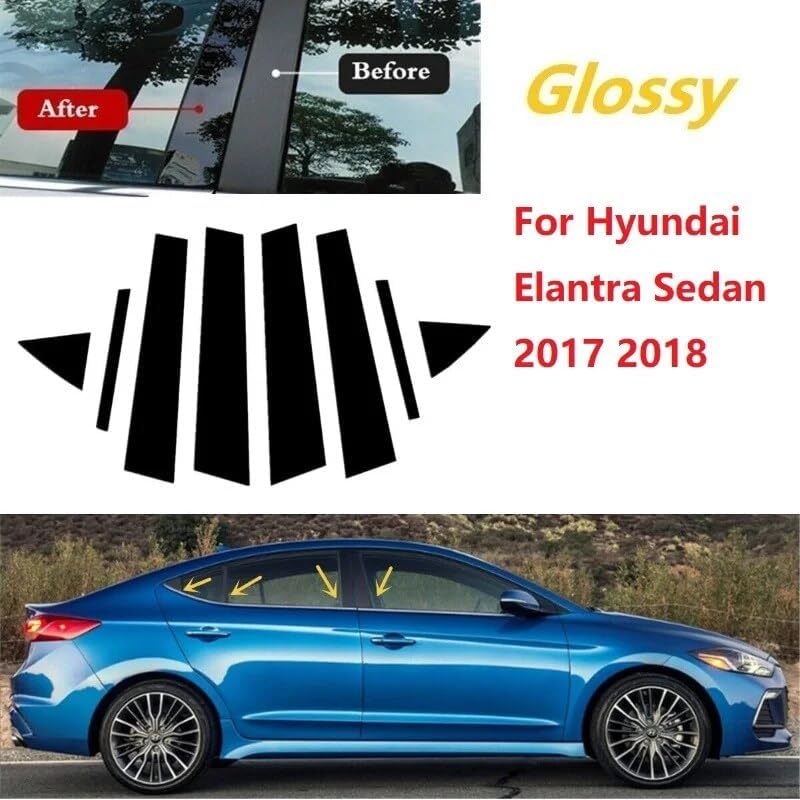 QASULER 8PCS Polished Pillar Posts for Hyundai Elantra 2017-2018 - Image 4