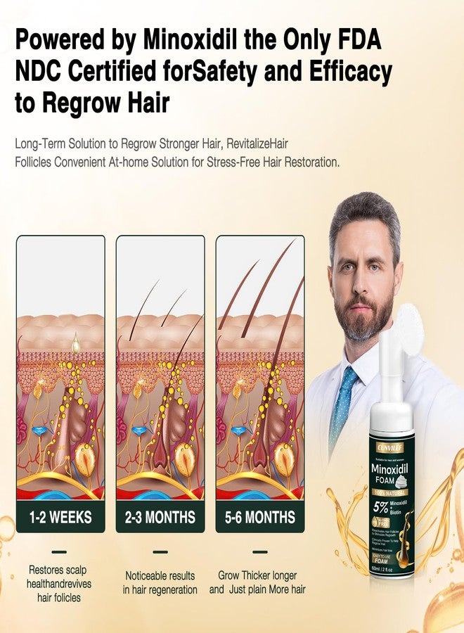 CUNVILEF 5% Minoxidil Foam for Men and Women Hair Growth, Slows Hair Loss and Promotes Hair Regrowth Treatment for Women and Men, Thicker Hair(6.33oz Pack of 3) - Image 4