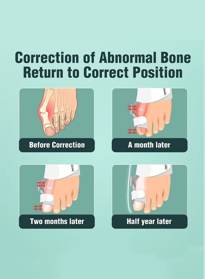 Captaintech 1 Pcs Orthopedic Bunion Toe Straightener, Adjustable Bunion Splint with Silicone Inner Pad for Bunion Relief - Image 5