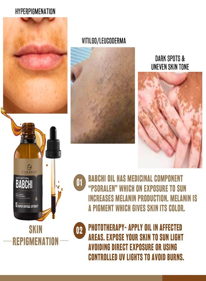 CARAWAY BABCHI OIL - Supercritical CO2 Extract| Pure Babchi oil for Skin, Pigmentation, Vitiligo & Uneven skin tone (30 ml) - Image 2