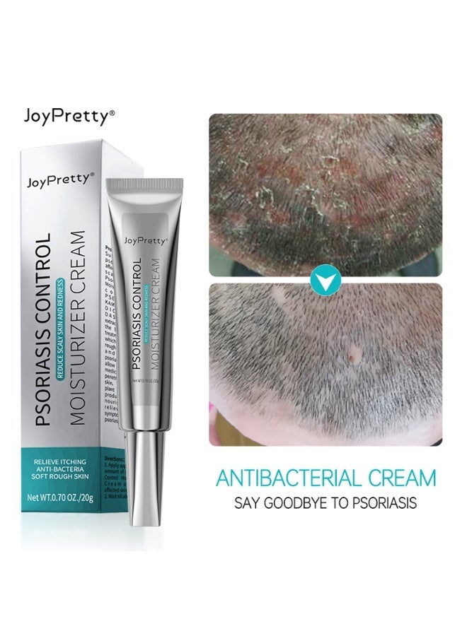 JoyPretty 2-PACKS Psoriasis Relief Cream , Anti-Bacterial Moisturizer for Scaly Skin  Redness – Natural Herbal Cream for Eczema, Dermatitis, Psoriasis, and Vitiligo – Unisex (20g*2) - Image 2
