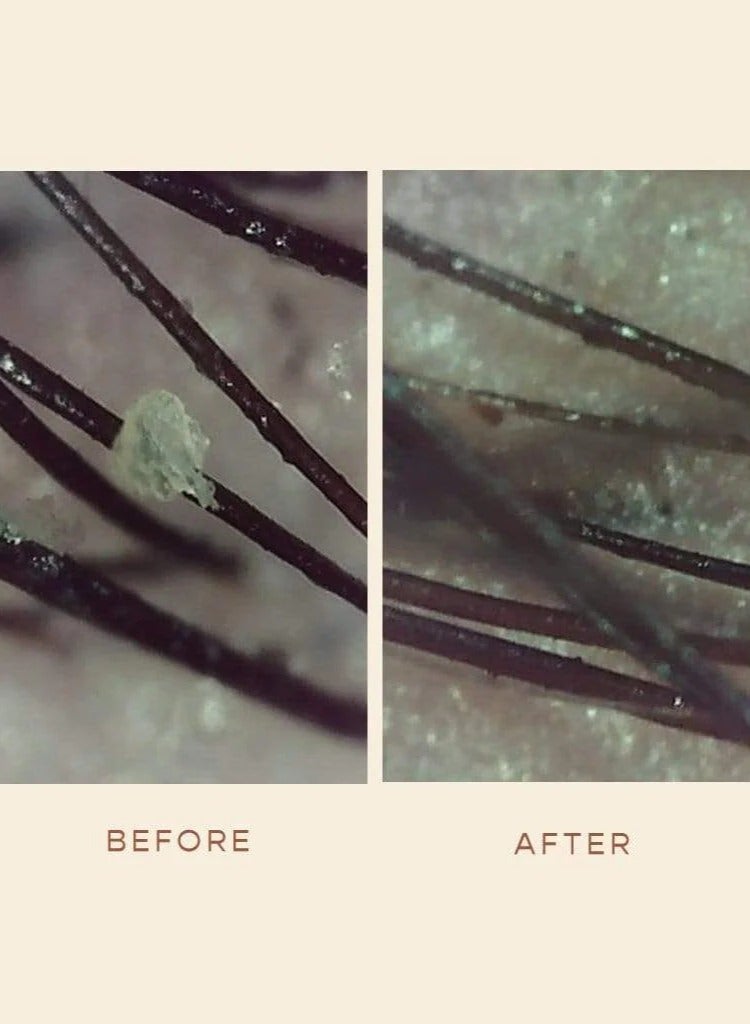 فيجامور مصل معالجة السموم لفروة الرأس من فيجامور جرو، 60 مل - Image 2