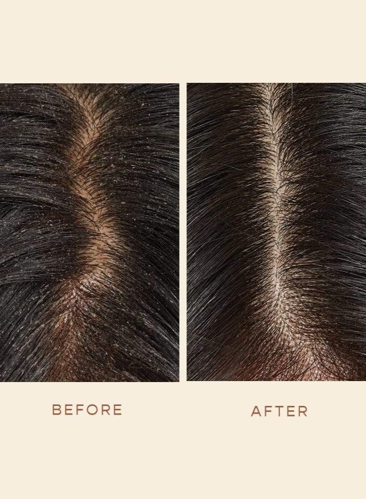 فيجامور مصل معالجة السموم لفروة الرأس من فيجامور جرو، 60 مل - Image 3