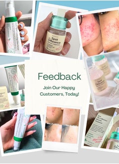 AXIS-Y Blemish Treatment - Targeted Spot Difference Solution and Dark Spot Glow Serum  - Image 2