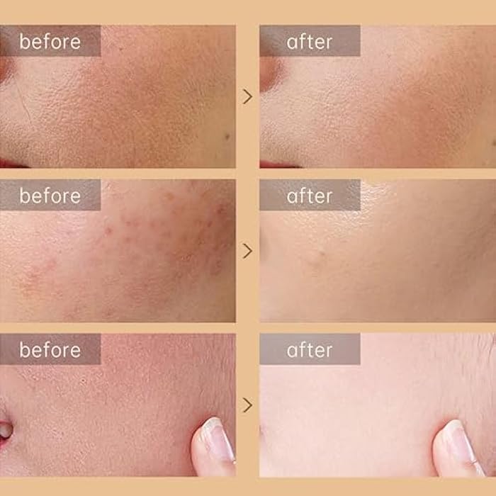 Rosarden Snail Repair Cream, Snail Moisturizer with Snail Secretion Filtrate, Repair Damage Skin, Ruduce Fine Line, Hydration Snail Face Cream for Dry Skin, Snail Mucin Essence for Women Skin Care - Image 5