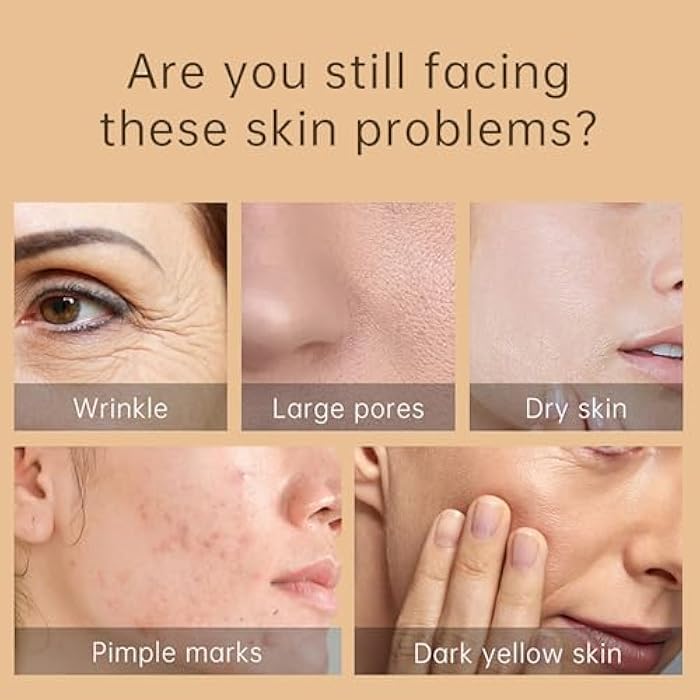 Rosarden Snail Repair Cream, Snail Moisturizer with Snail Secretion Filtrate, Repair Damage Skin, Ruduce Fine Line, Hydration Snail Face Cream for Dry Skin, Snail Mucin Essence for Women Skin Care - Image 2