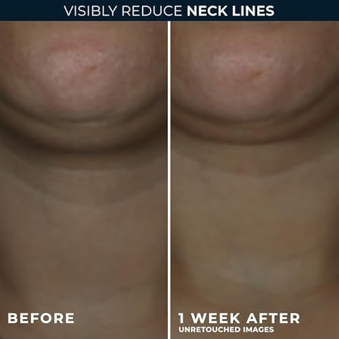 RoC Derm Correxion Neck Cream with Hyaluronic Acid + Advanced Retinol to visibly Tighten & Lift Horizontal Neck Lines, Facial Moisturizer to Contour Face (1.7 oz) with RoC Retinol Eye Packette - Image 5