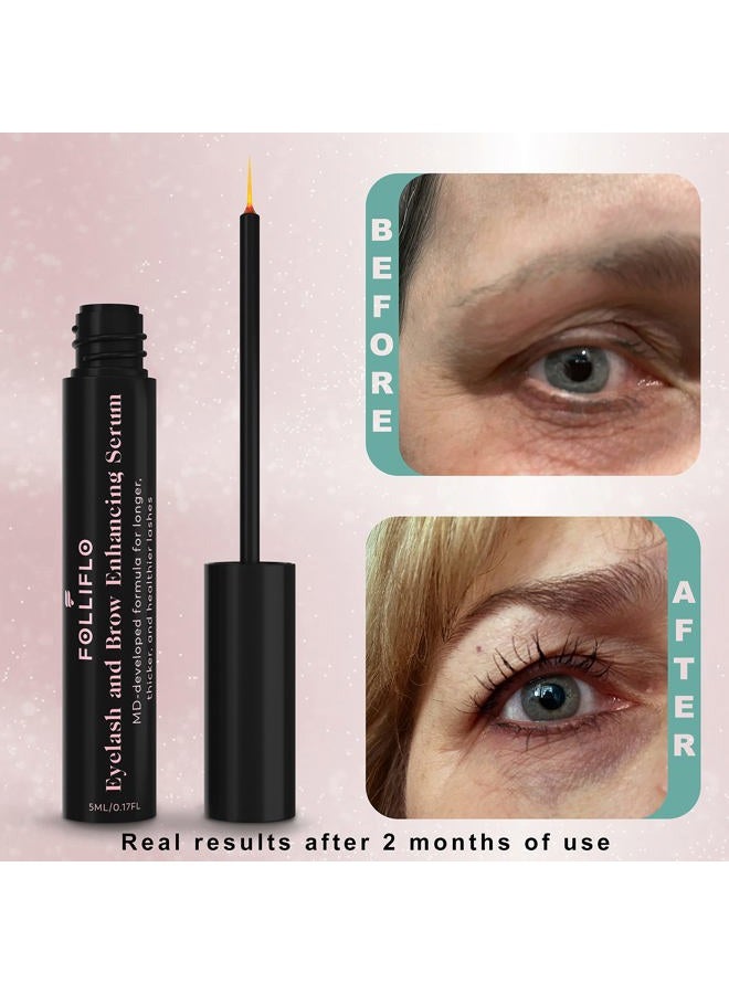 Folliflo by CELL ACCEL Eyelash & Brow Enhancing Serum with Castor Oil & Panax Ginseng - Hair Growth Formula for Longer, Thicker & Healthier Lashes - Developed by a Harvard-Trained Dermatologist - Image 3