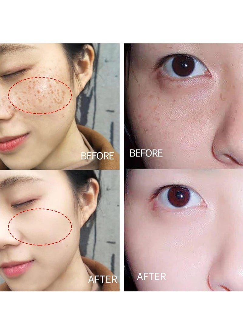 Lanthome - Glutathione White Cream Facial Dark Spots Remover 2% Glutathione Face Cream Whitening Moisturizing Facial Cream Face Moisturizer Facial Skin Care Cream Intensive Lightening Facial Cream 20g - Image 1