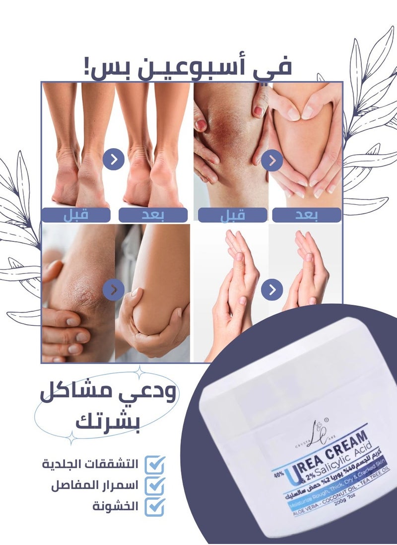 crystal & care - Urea 40% Cream with Salicylic Acid - Advanced formula for deep hydration, gentle exfoliation, treatment of cracks and roughness, lightening of knees and elbows, and cleansing of dead skin with coconut oil, aloe vera, and tea tree oil - Image 1