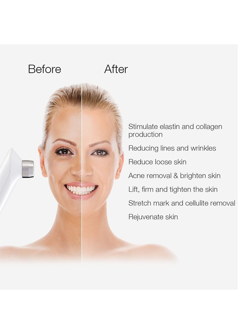 MLAY - RF Radio Frequency Facial And Body Skin Tightening Machine Professional Home  Lifting Skin Care Anti Aging Device Salon Effects - Image 1
