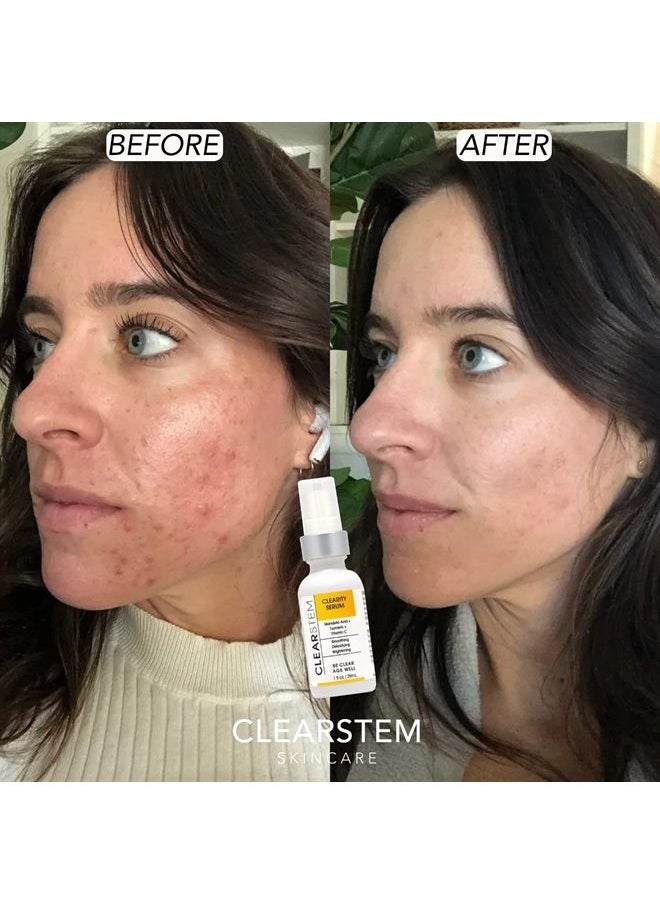 CLEARstem CLEARITY Exfoliating Facial Serum with Vitamin C, Turmeric and Mandelic Acid, 1 Oz  - Image 2