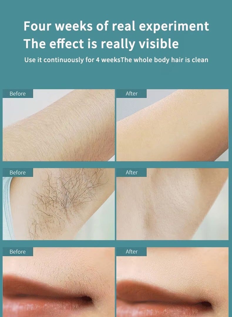 Loquat Laser hair removal device IPL hair removal device is suitable for female facial, body, and leg hair removal bikini laser threading machine - Image 3