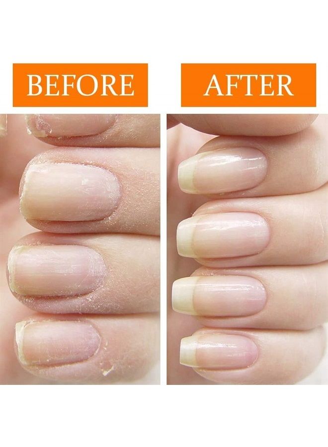 Nail Tek Nail Recovery Kit, Cuticle Oil, Strengthener, Ridge Filler - Restore Damaged Nails in 3 Steps - Image 5