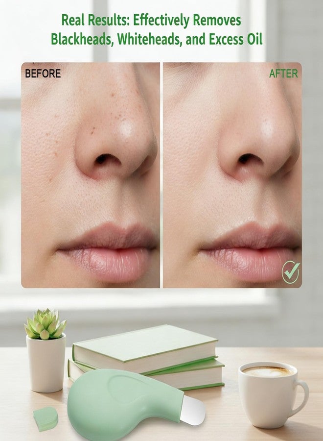 Psiriol Silicone Nose Blackhead Remover, Blackhead Remover Tool, Deep Skin Scrubber Face Spatula, Mild and Safe Face Scraper for Remove Facial and Nose Ehead for Men and Women, Green - Image 5